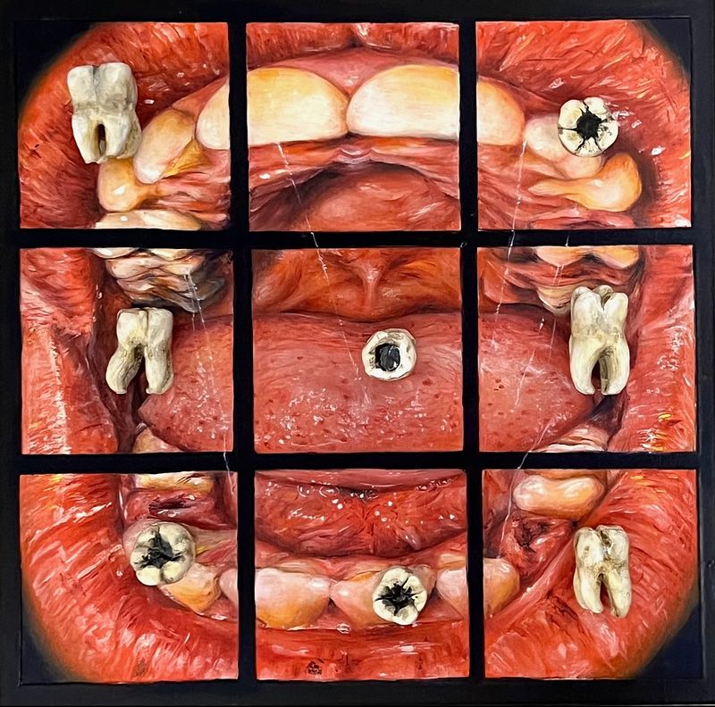 "Teeth Tac Toe" 2025