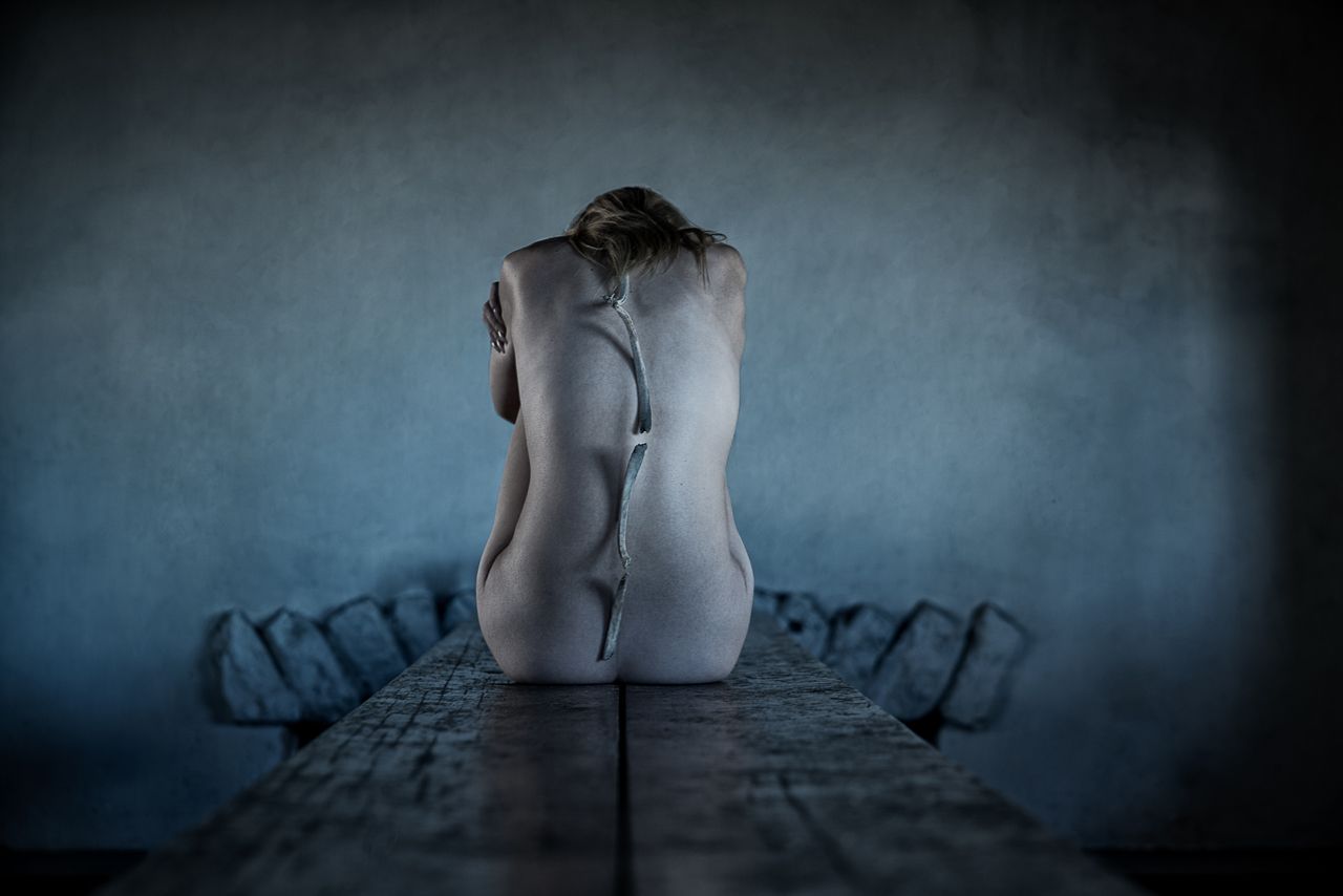 Skin And Bone